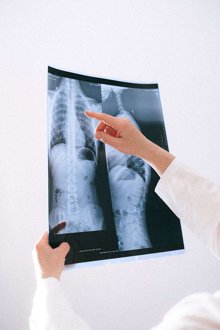 A medical professional examines a chest x-ray to diagnose health issues.